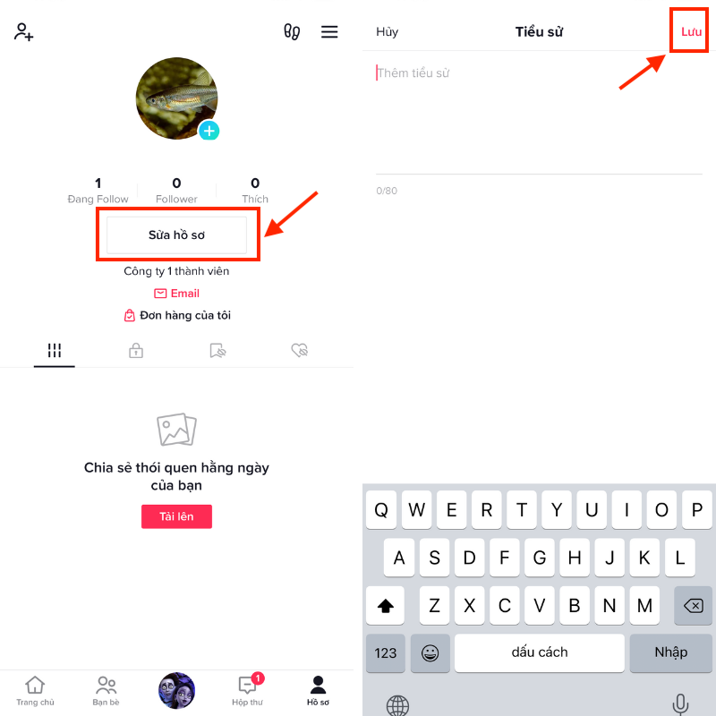 Cách gắn link bio trên TikTok